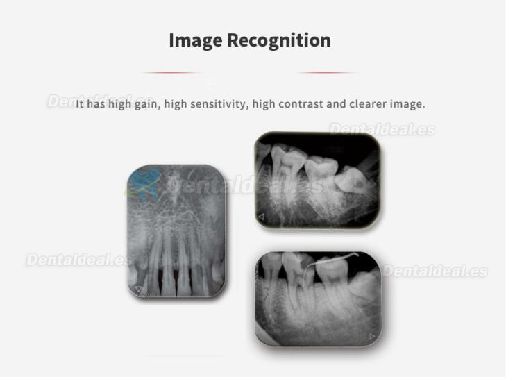 Handy HDS-500 Escáner de Placas Fotoestimulables de Odontología Escáner de Placas Fósforo